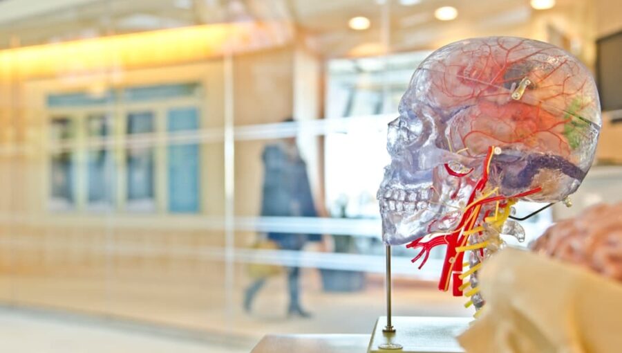 Photo Brain scan