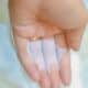 Photo The Future of Wearable Patches for Continuous Glucose Monitoring