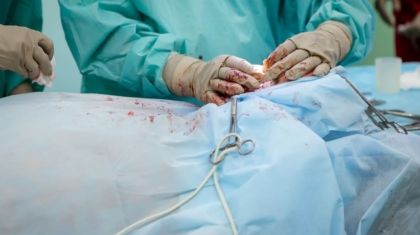 Photo Microbot Surgery
