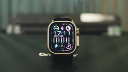 Photo Smartwatch monitoring