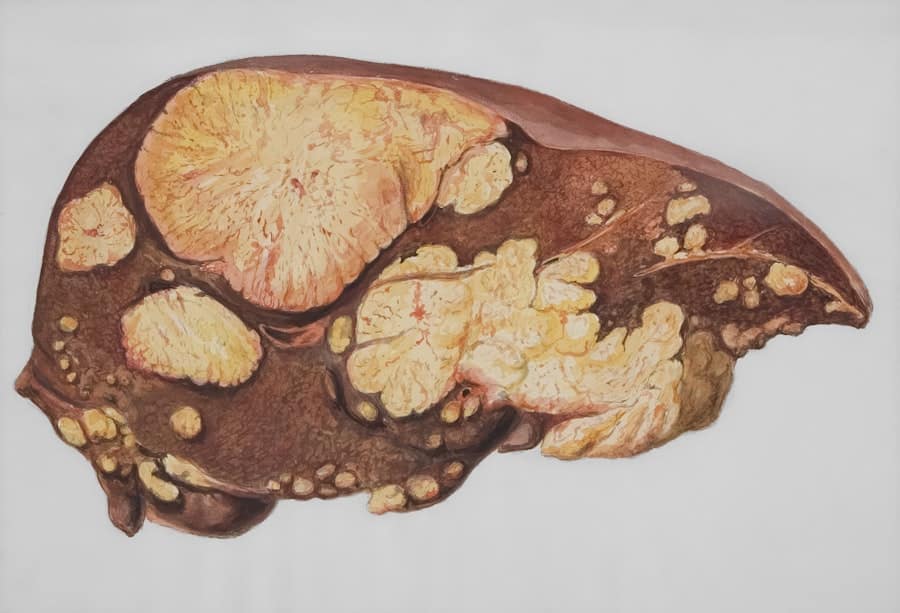 Bioprinted liver