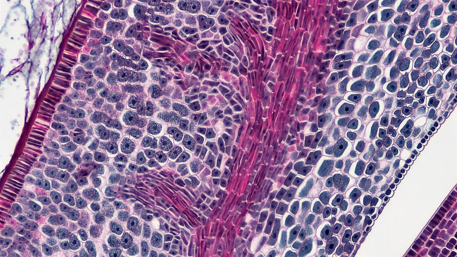 Cell infusion