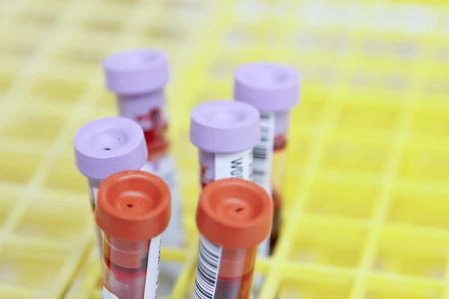 Genetic testing