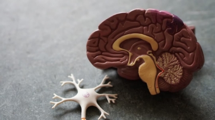 Photo Brain scan