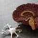 Photo Brain scan