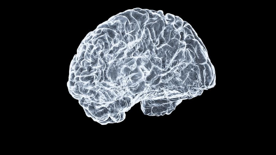 Photo Brain scan