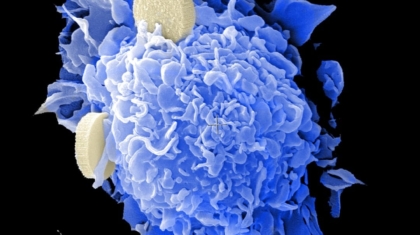 Photo Cell infusion