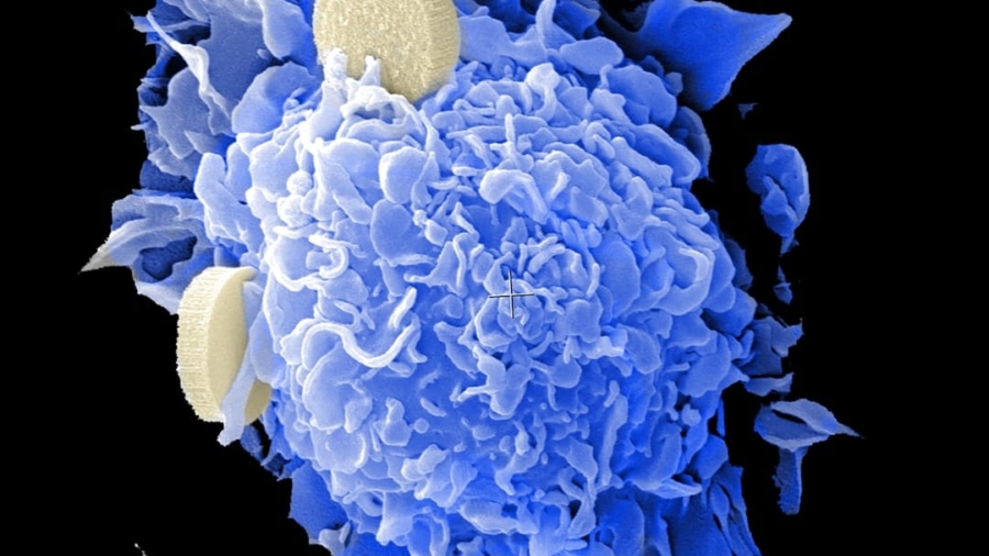 Photo Cell infusion