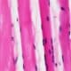 Photo Bioprinted skin