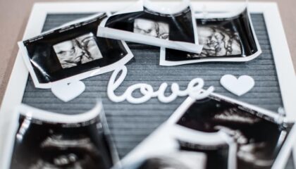 Photo Ultrasound scan