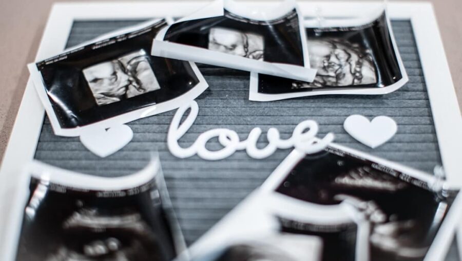 Photo Ultrasound scan