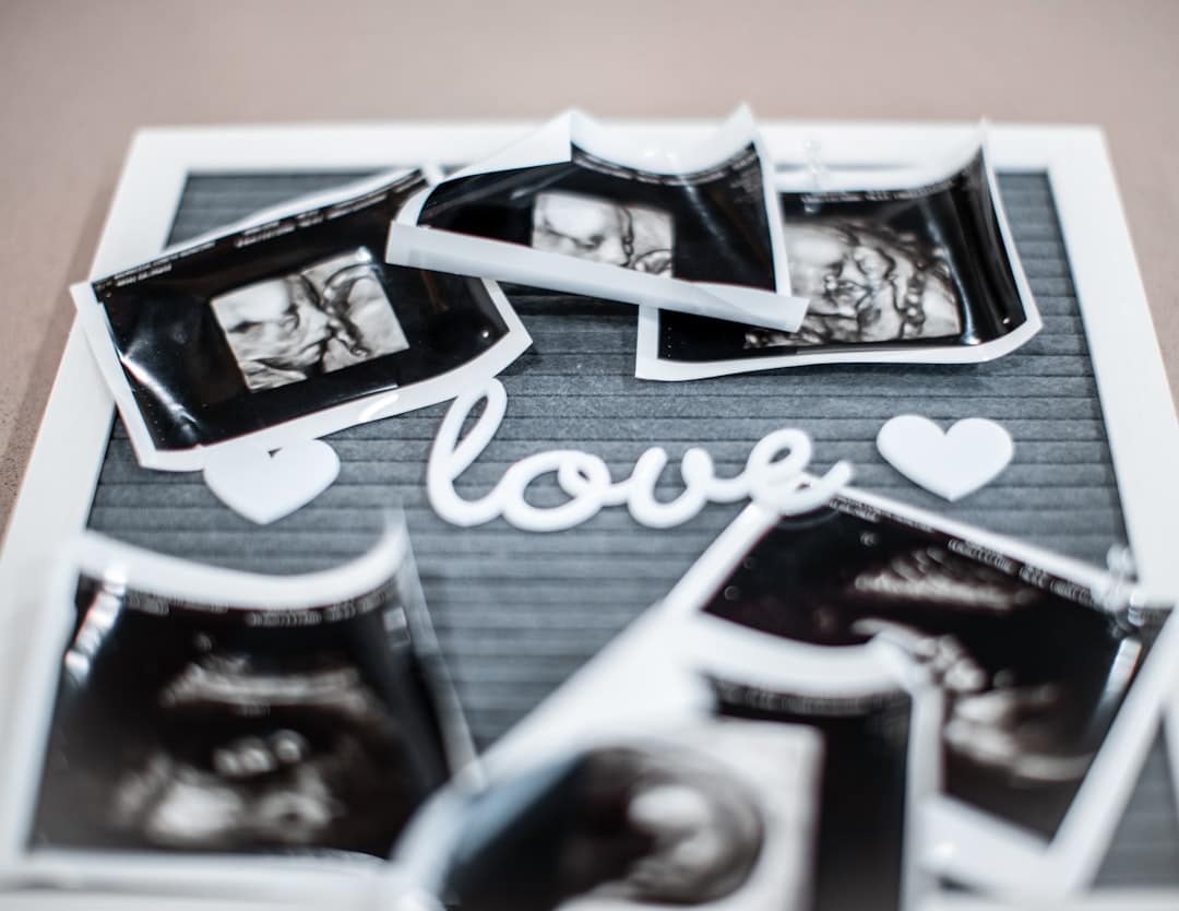 Photo Ultrasound scan