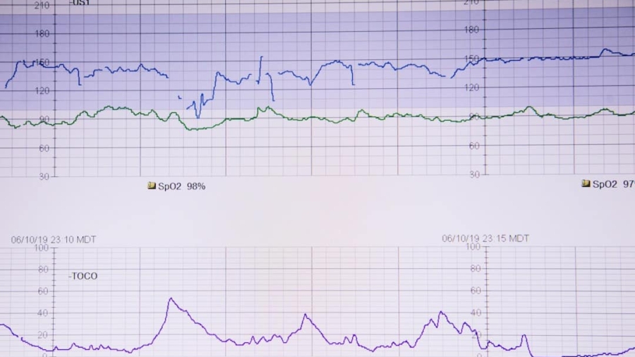 Photo AI in Predictive Healthcare