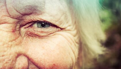Photo Longevity Research