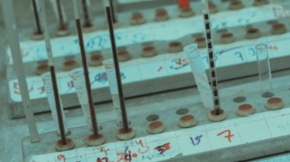 Photo Bioinformatics