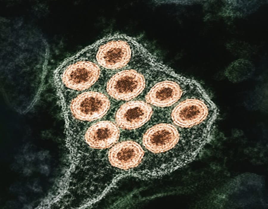 Photo AI in Outbreak Detection Systems