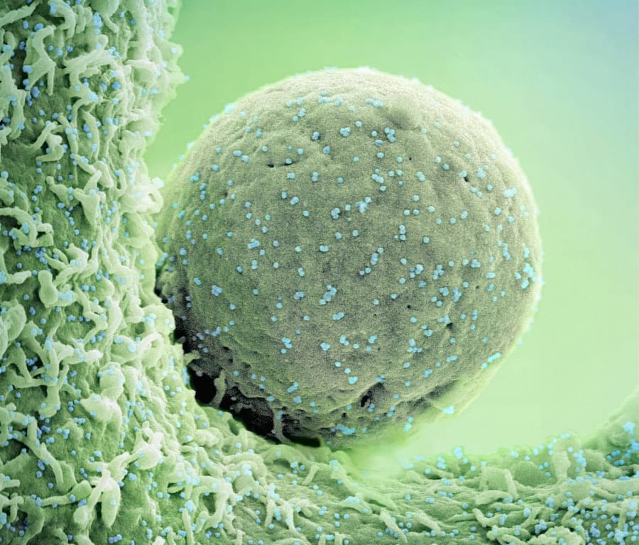 Photo Cell and Gene Therapies