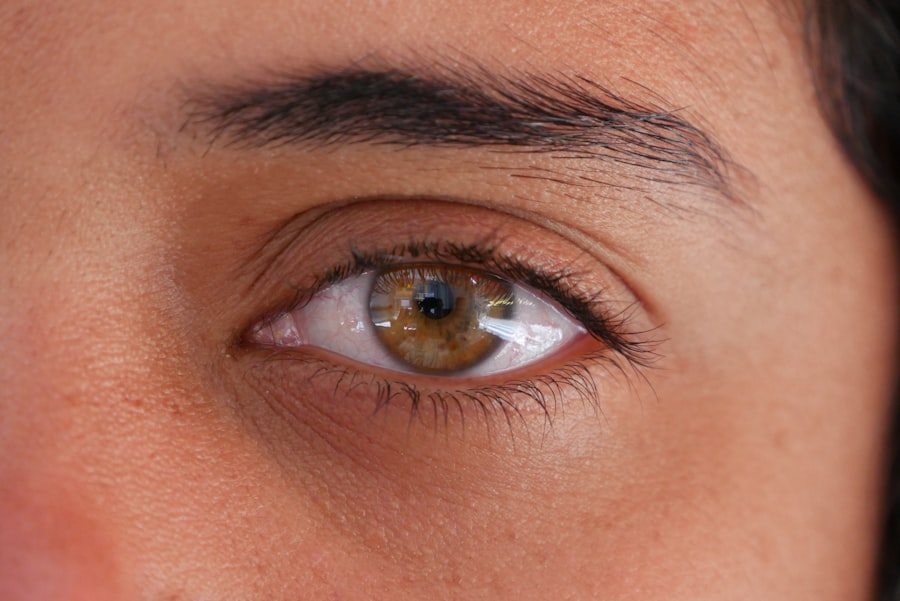 Contact Lenses