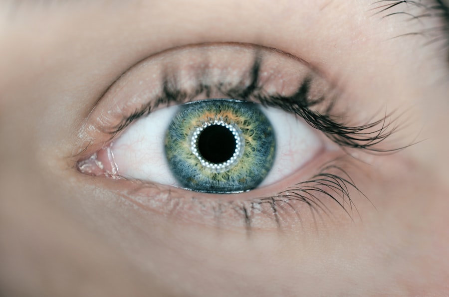 Photo Contact Lenses
