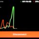Photo Dynamic Difficulty Adjustment Algorithms