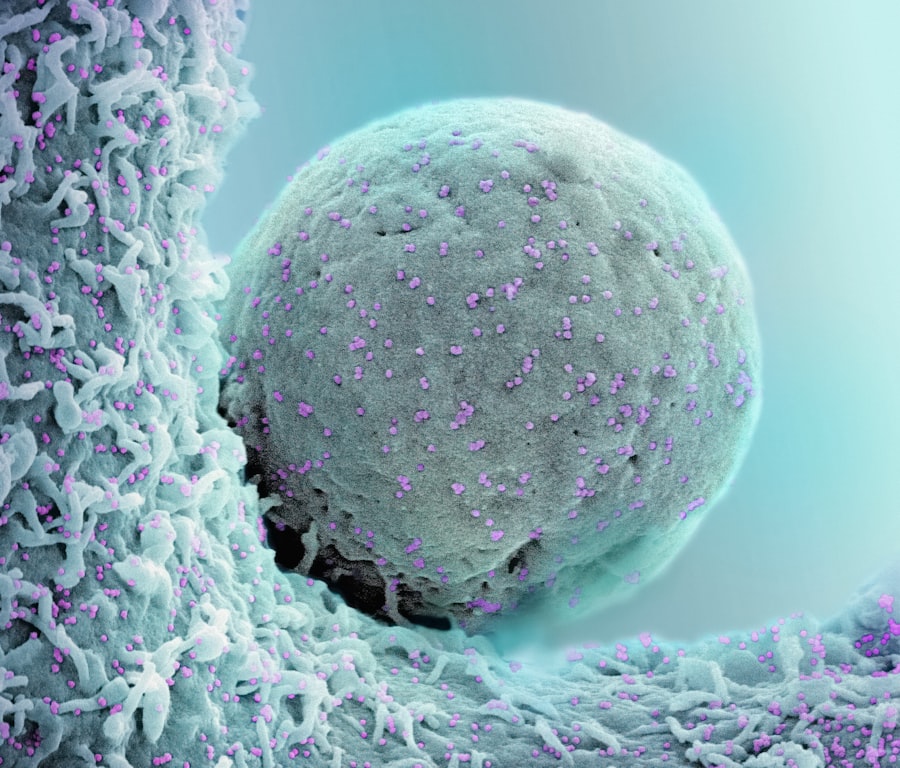 Autoimmune Conditions