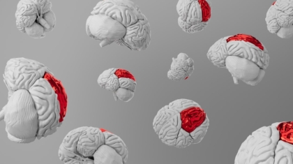 Photo Neurological Conditions