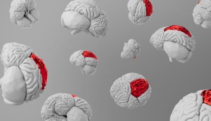 Photo Neurological Conditions
