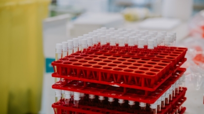 Photo Lab-Grown Blood Formulations