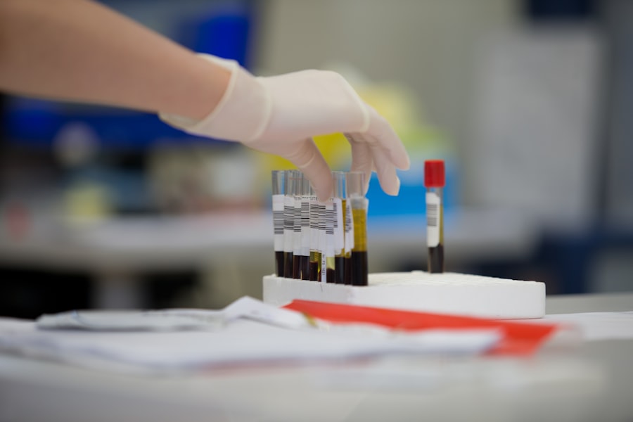 Engineering Lab-Grown Blood Formulations for Emergency Transfusions 2 Photo Lab-Grown Blood Formulations