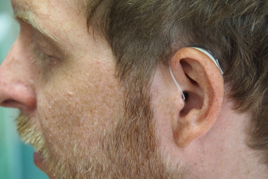 Smart Hearing Aids