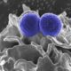 Photo Multi-Cancer Early Detection (MCED) Liquid Biopsies