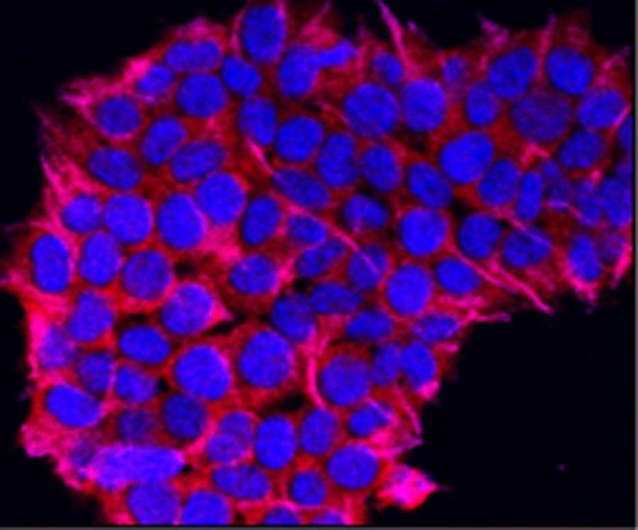 Photo Multi-Cancer Early Detection (MCED) Liquid Biopsies
