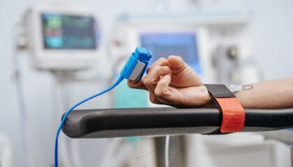 Photo Pulse Oximetry