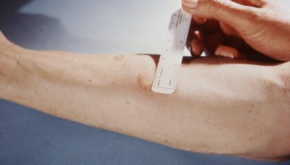 Photo Electrodermal Activity Sensors