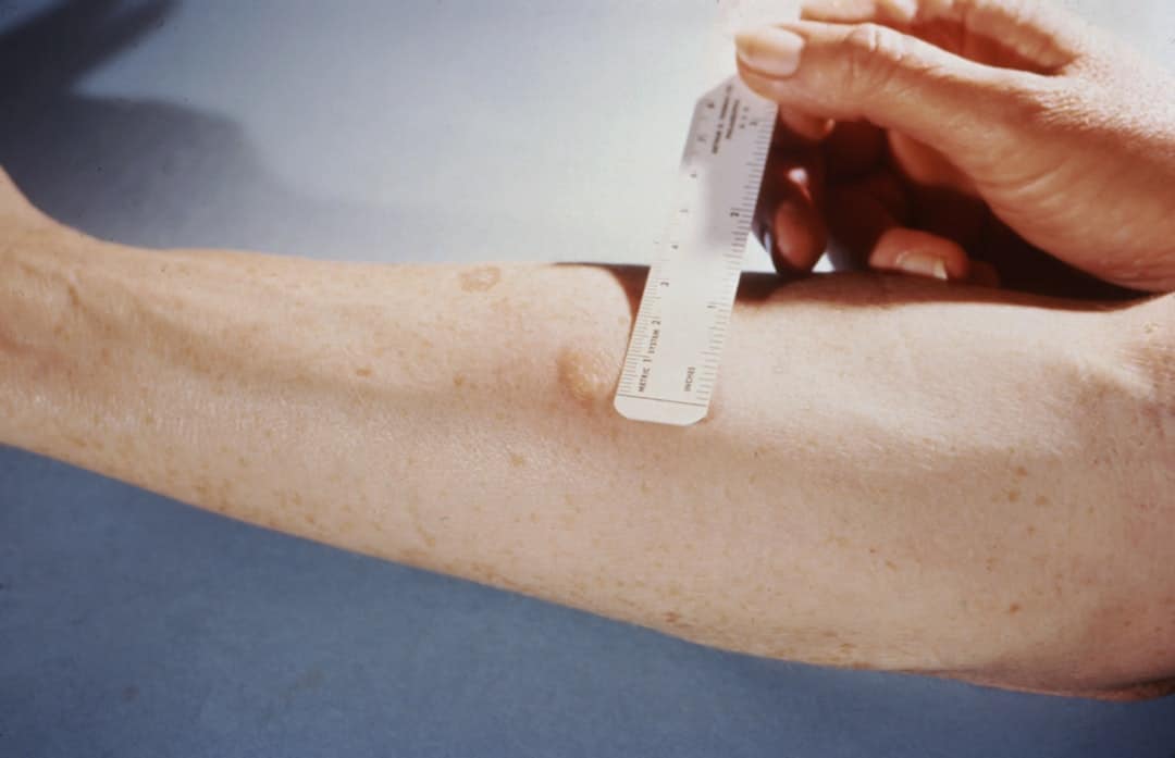 Photo Electrodermal Activity Sensors