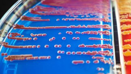 Photo Microfluidic Diagnostics