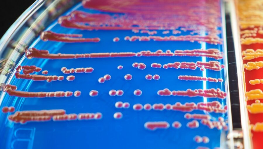 Photo Microfluidic Diagnostics