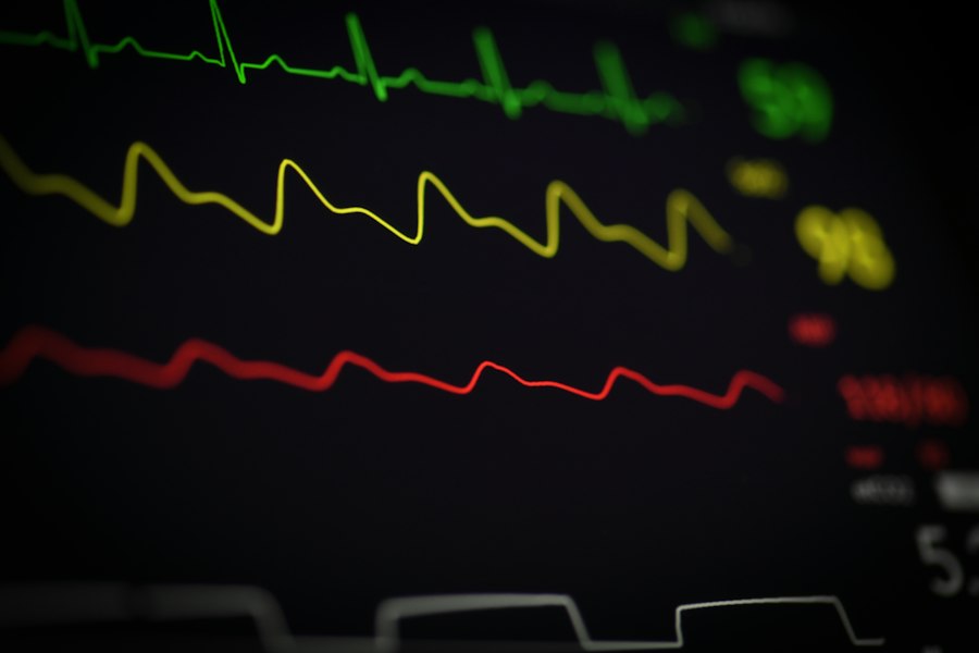 Next-Gen ECG Wearables Atrial Fibrillation Detection