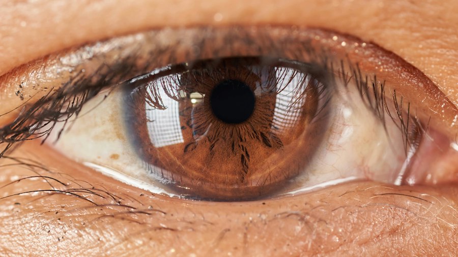 smart contact lenses intraocular pressure glucose monitoring